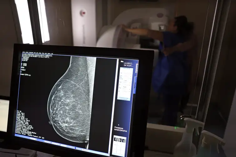 Brasília (DF), 01/10/2024 - Teste de mamografia realizado na Campanha Outubro Rosa: Sesc-DF, que oferece exames e consultas gratuitas às mulheres.  Foto: José Cruz/Agência Brasil