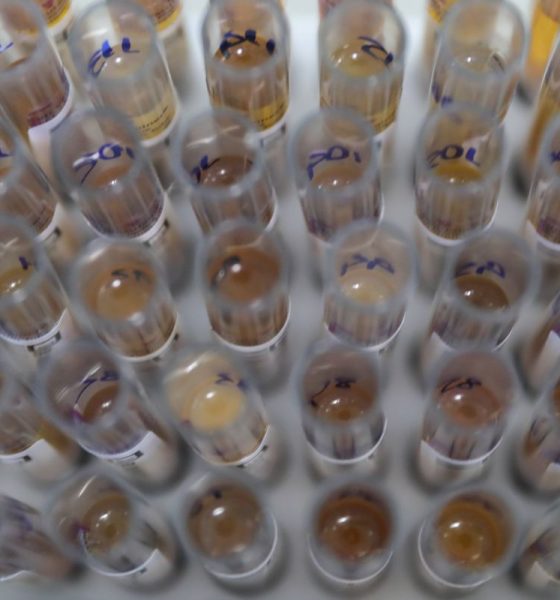 Uso de medicamento disponibilizado pelo SUS diminui casos de malária no Brasil