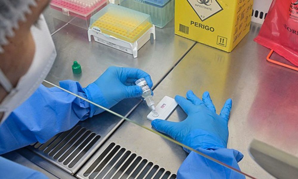 Anvisa revisa normas de controle de qualidade em laboratórios