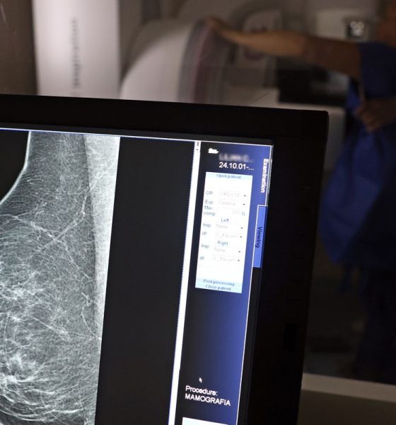 Plano de saúde deverá cobrir mamografia digital para todas as faixas etárias