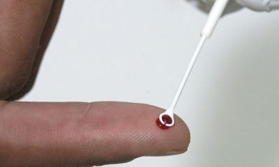 Fiji declara emergência nacional devido à alta taxa de HIV, com 1 caso a cada 60 pessoas
